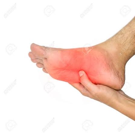 What Is Neuropathy? Symptoms, Causes, and Treatment Explained